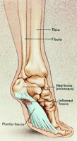 Heel Pain, Plantar Fasciitis | Masterton Foot Clinic, NZ